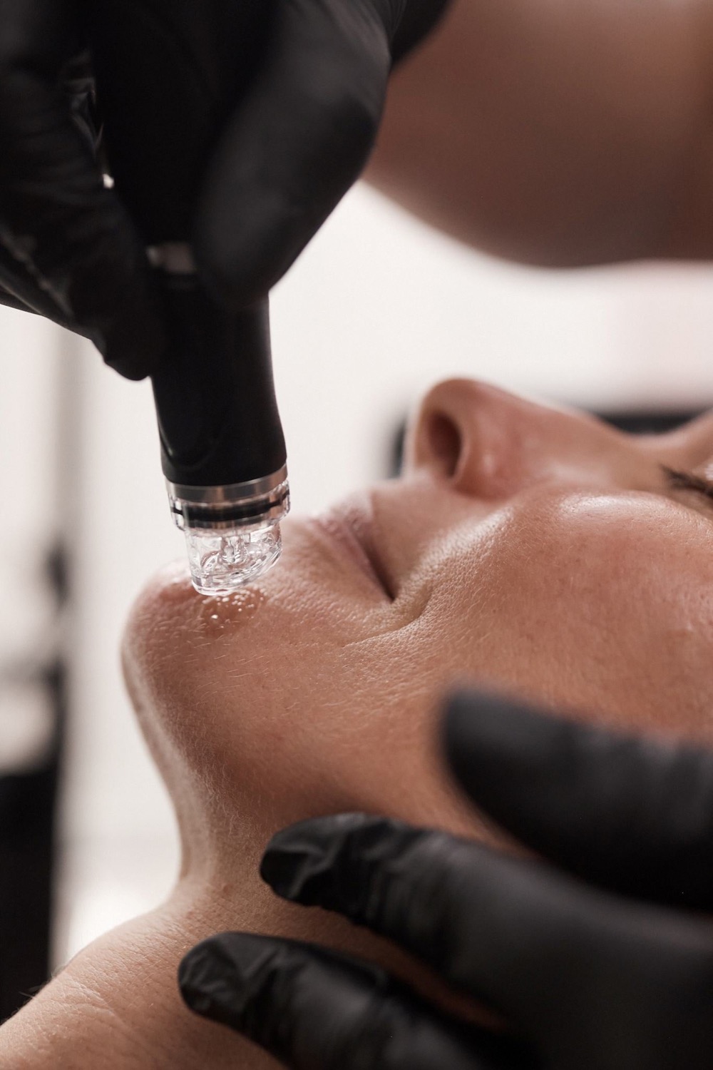 Hydrafacial booster treatment applied with a handpiece