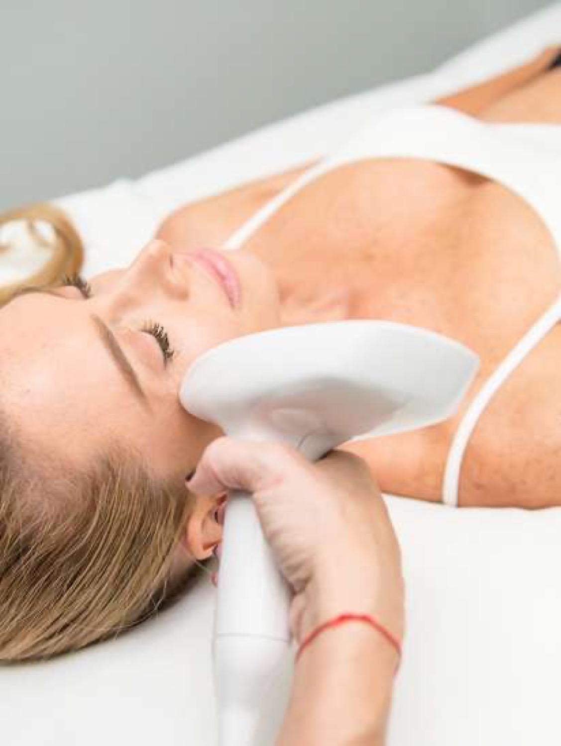 Venus manufacturer photograph of a facial skin-resurfacing treatment